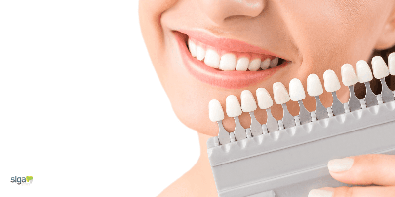 Os Principais Benefícios das Facetas de Resina para a Estética Dentária